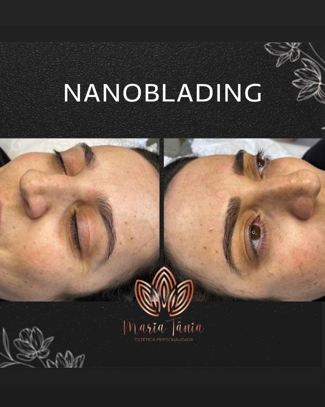 Nanoblading antes e depois