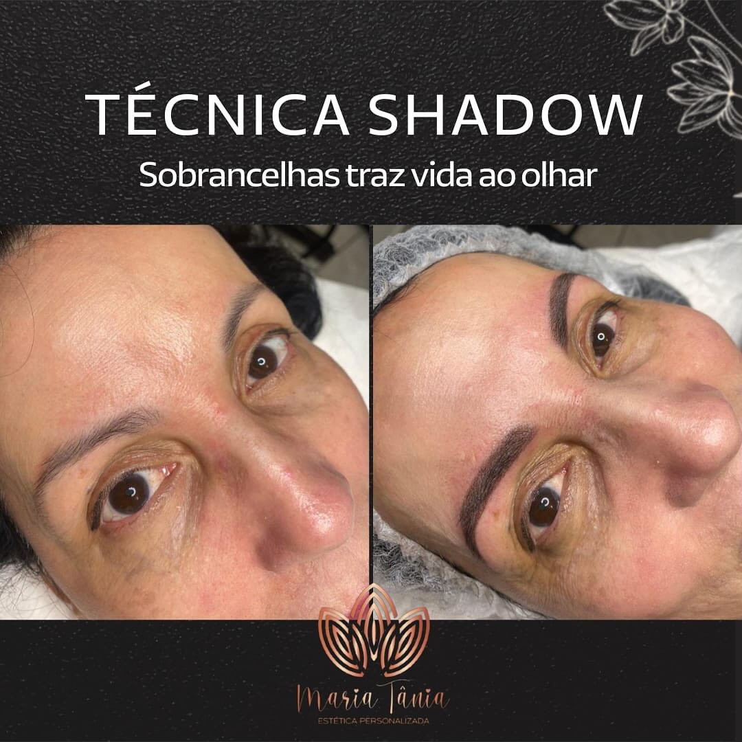 Micropigmentação shadow antes e depois